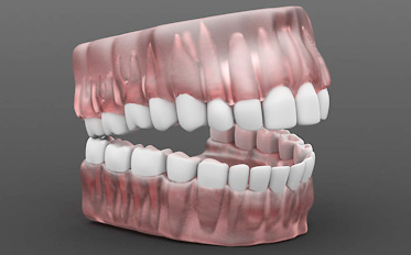 3D Drucker Modell der Zähne und Zahnreihen - Moderne Technik