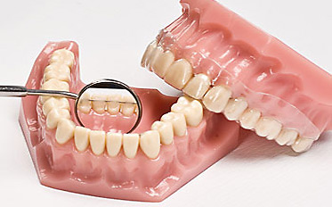 Retention Maßnahmen für dauerhaft gerade Zähne
