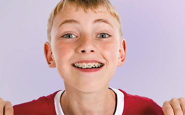 Zahnschienen und Zahnspangen für Kinder und Jugendliche