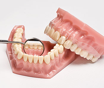 Retention für dauerhaft gerade Zähne